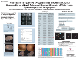 T237M Mutation in ALPK1 Is Identified As the Likely Causative Mutation In