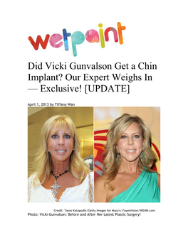 Did Vicki Gunvalson Get a Chin Implant? Our Expert Weighs in — Exclusive! [UPDATE]