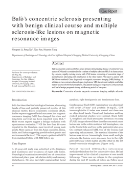 Balò's Concentric Sclerosis Presenting with Benign Clinical Course and Multiple Sclerosis-Like Lesions on Magnetic Resonance