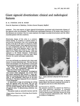 Giant Sigmoid Diverticulum: Clinical and Radiological Features