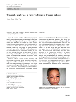 Traumatic Asphyxia: a Rare Syndrome in Trauma Patients