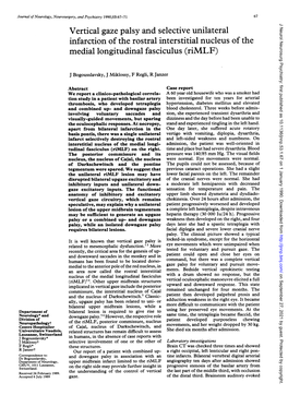 Vertical Gaze Palsy and Selective Unilateral Medial Longitudinal