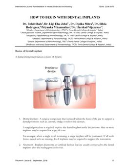 How to Begin with Dental Implants