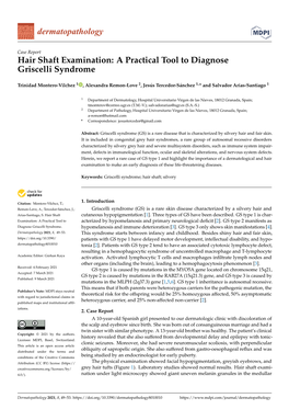 Hair Shaft Examination: a Practical Tool to Diagnose Griscelli Syndrome