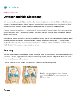 Osteochondritis Dissecans