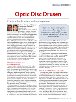 Optic Disc Drusen