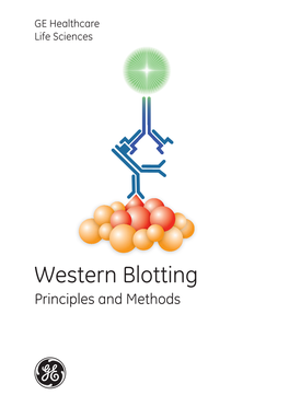 Western Blotting Principles and Methods