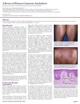 A Review of Primary Cutaneous Amyloidosis Jared Heaton, DO,* Natalie Steinhoff, DO,** Brian Wanner, BA,*** Michael Krutchik, DO****