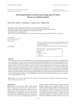 Oral Manifestations As the First Presenting Sign of Crohn's Disease