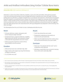 Ankle and Hindfoot Arthrodesis Using Vivigen® Cellular Bone Matrix