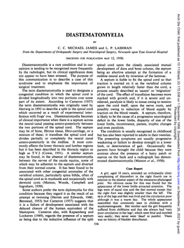 Diastematomyelia