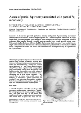 A Case of Partial 5Q Trisomy Associated with Partial 7Q Monosomy