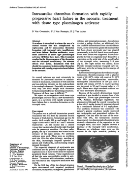 Progressive Heart Failure in the Neonate: Treatment with Tissue Type Plasminogen Activator