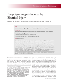 Pemphigus Vulgaris Induced by Electrical Injury