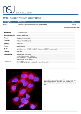TUBB1 Antibody / Tubulin Beta (RQ5777)