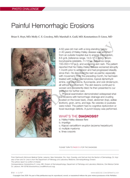Painful Hemorrhagic Erosions