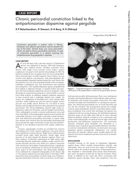 Chronic Pericardial Constriction Linked to the Antiparkinsonian Dopamine Agonist Pergolide K P Balachandran, D Stewart, G a Berg, K G Oldroyd