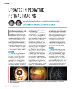 Updates in Pediatric Retinal Imaging