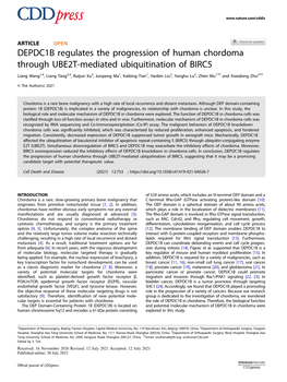 DEPDC1B Regulates the Progression of Human Chordoma Through