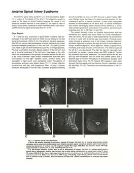 Anterior Spinal Artery Syndrome