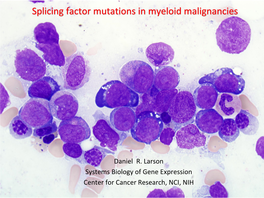 Splicing Factor Mutations in Myeloid Malignancies