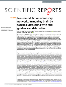 Neuromodulation of Sensory Networks in Monkey Brain by Focused