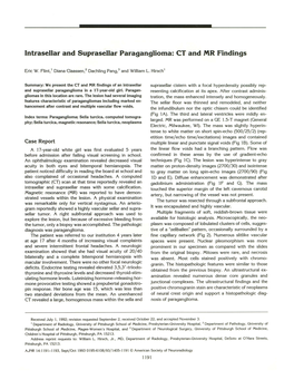 Lntrasellar and Suprasellar Paraganglioma: CT and MR Findings