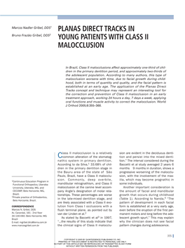 Planas Direct Tracks in Young Patients with Class Ii