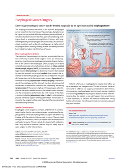 Esophageal Cancer Surgery