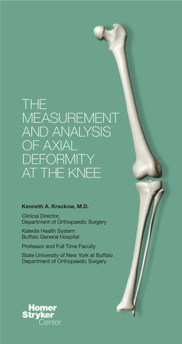How to Measure Knee Alignment