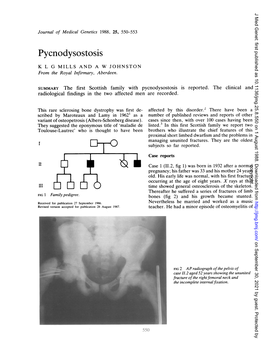 Pycnodysostosis