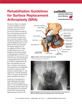 Rehabilitation Guidelines for Surface Replacement Arthroplasty (SRA)