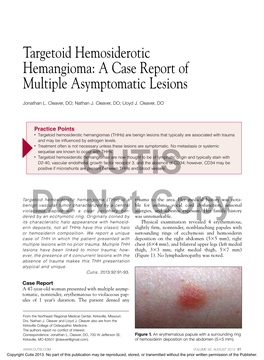 Targetoid Hemosiderotic Hemangioma: a Case Report of Multiple Asymptomatic Lesions