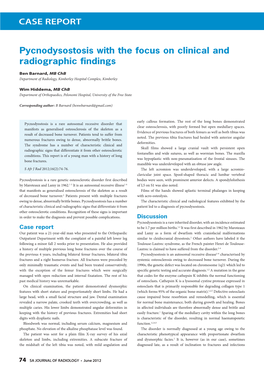 Pycnodysostosis with the Focus on Clinical and Radiographic Findings