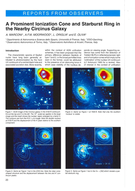 A Prominent Ionization Cone and Starburst Ring in the Nearby Circinus Galaxy