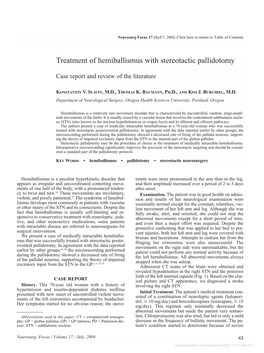 Treatment of Hemiballismus with Stereotactic Pallidotomy