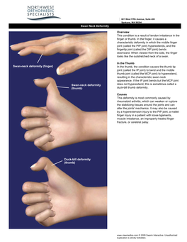 Finger) Swan-Neck Deformity (Thumb