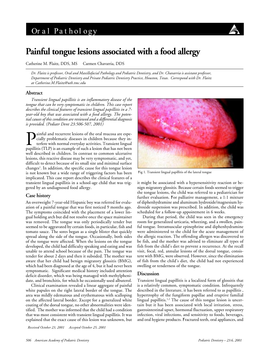 Painful Tongue Lesions Associated with a Food Allergy