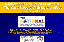 The Many Types of Arthritis That Affect Our Patients!”