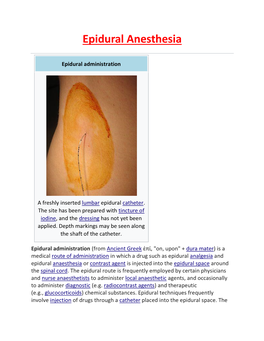 Epidural Anesthesia