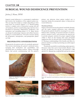 Surgical Wound Dehiscence Prevention