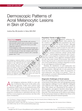 Dermoscopic Patterns of Acral Melanocytic Lesions in Skin of Color