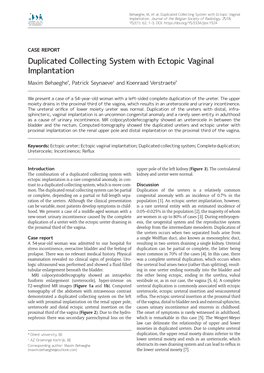 Duplicated Collecting System with Ectopic Vaginal Implantation
