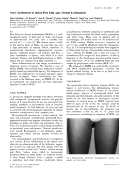 Nerve Involvement in Indian Post Kala-Azar Dermal Leishmaniasis