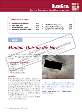 Multiple Dots on the Face P.34 2