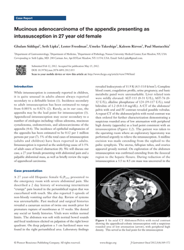 Mucinous Adenocarcinoma of the Appendix Presenting As Intussusception in 27 Year Old Female