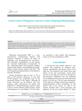 A Rare Cause of Hypopyon Anterior Uveitis: Relapsing Polychondritis