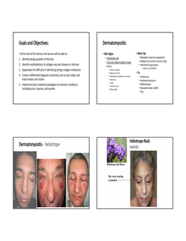 Heliotrope Rash • Myopathy (May Be Amyopathic) • Cuticular Dilated Capillary Loops • Malignancy (Ovarian, Breast, Lung) 2