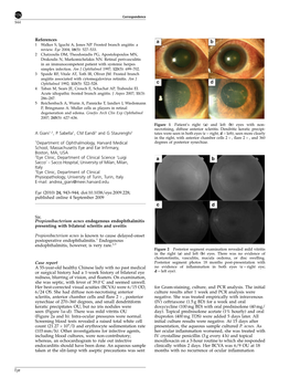 Propionibacterium Acnes Endogenous Endophthalmitis Presenting with Bilateral Scleritis and Uveitis