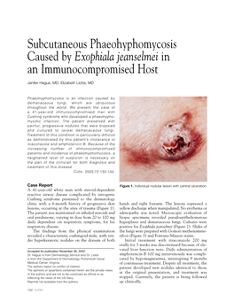 Subcutaneous Phaeohyphomycosis Caused by Exophiala Jeanselmei in an Immunocompromised Host